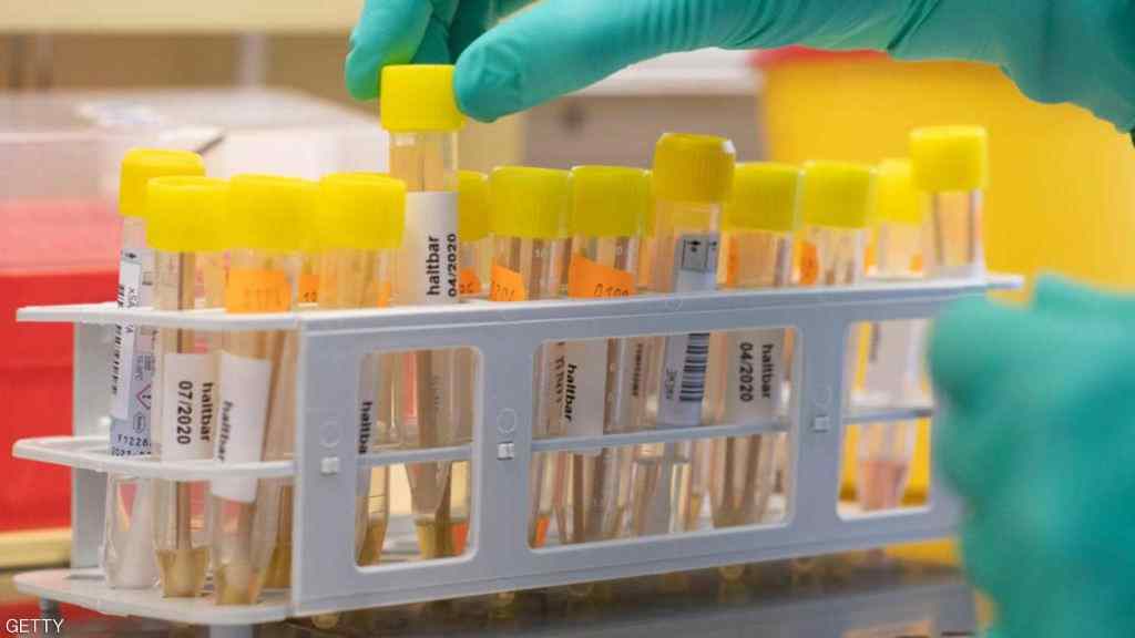 ألمانيا..نتائج طبية مبشرة للتصدي لفيروس كورونا&nbsp;الجديد