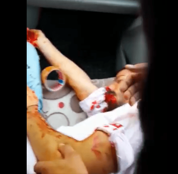 بالسكاكين والعصي.. أتراك يعتدون على شباب وصبايا&nbsp;سوريين