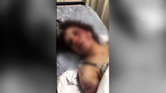 سوري يعذب زوجته بطريقة وحشية في&nbsp;تركيا